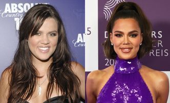 Khloe Kardashian wymienia zabiegi, jakim się poddała: operacja nosa, botoks, nici kolagenowe...