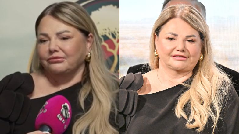 Katarzyna Niezgoda doznała paraliżu twarzy. Mówi o liftingu