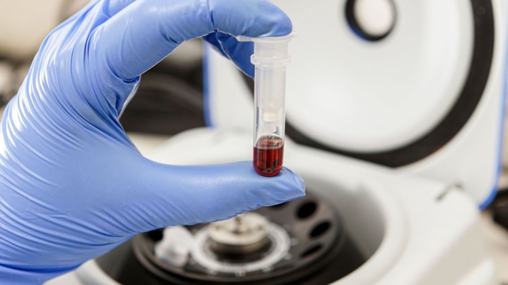 Badanie krwi w laboratorium