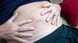 Stłuszczenie wątroby rozwija się powoli. Te owoce pomagają w regeneracji narządu