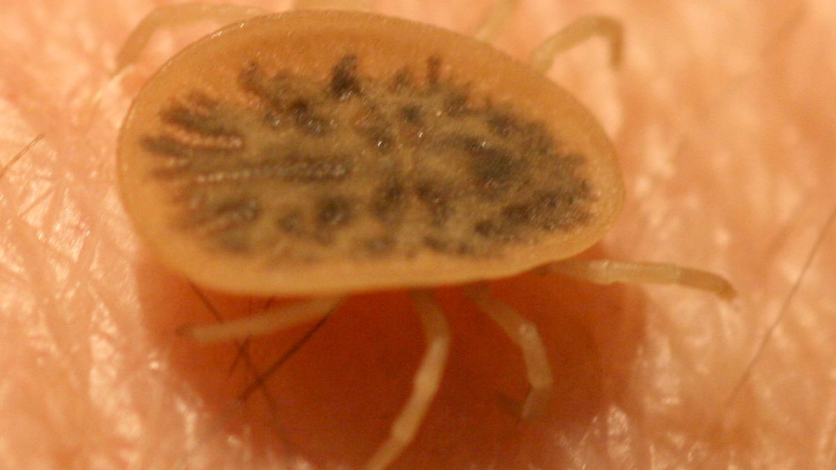 Obrzeżek gołębi na ludzkiej skórze