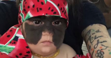 Przed operacją mówiono na nią "Batmanka". Tak dziewczynka wygląda dziś