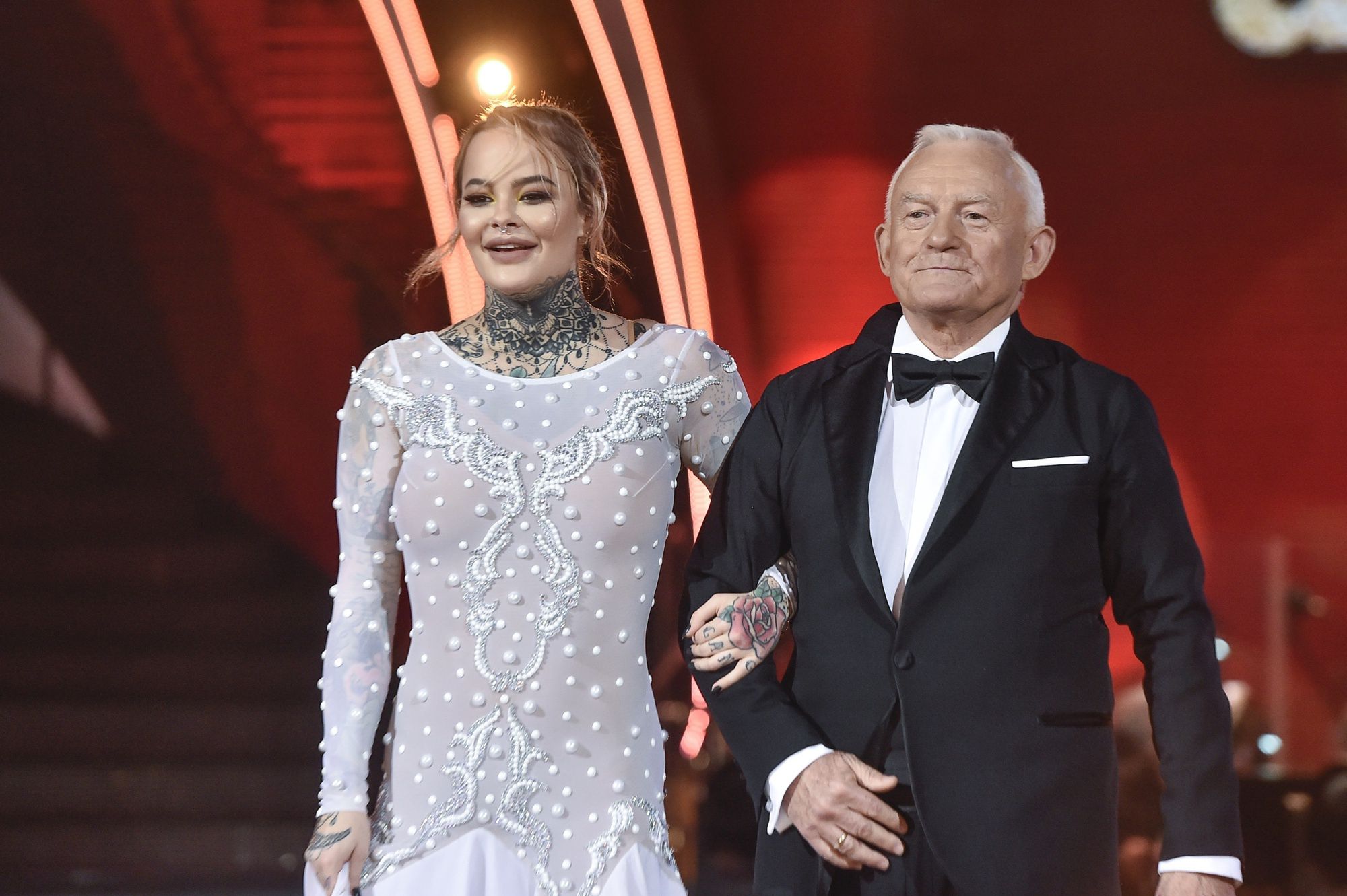 Monikę Miller czeka przeszczep włosów