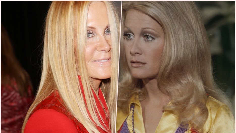 Joan Van Ark zasłynęła ze swojego zamiłowania do operacji plastycznych