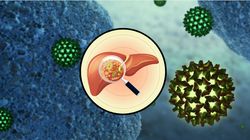 Wirusowe zapalenie wątroby typu A (WZW) - przyczyny, leczenie, epidemia