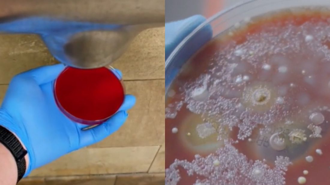 Tak rozwijały się bakterie na płytce osuszonej suszarką do rąk