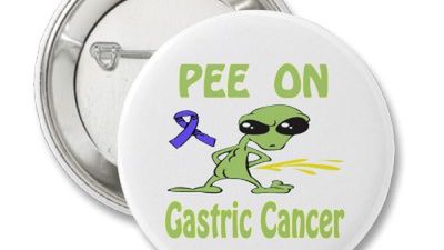 Znamy już gen wywołujący raka żołądka 1