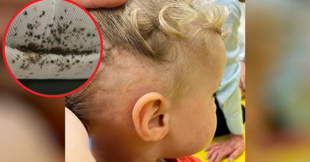 Zauważyła rany na głowie 2-latka. Zamarła, gdy sprawdziła łóżko