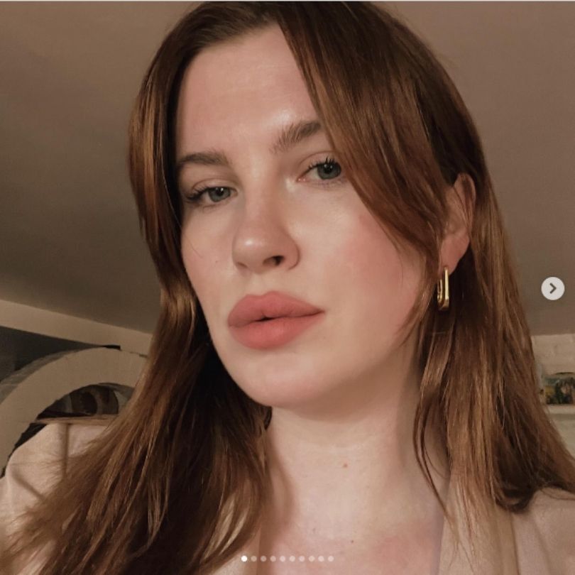 Ireland Baldwin tłumaczy się z zabiegu podbródka