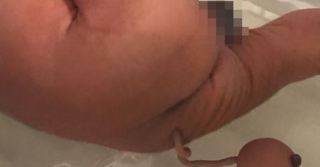 Nietypowy noworodek w Brazylii. Lekarze przecierali oczy ze zdziwienia