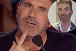 Simon Cowell nagrał wideo. Fani pytają, co dzieje się z jego twarzą. "Jest nie do rozpoznania"