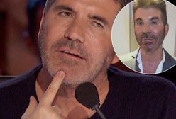 Simon Cowell nagrał wideo. Fani pytają, co dzieje się z jego twarzą. "Jest nie do rozpoznania"