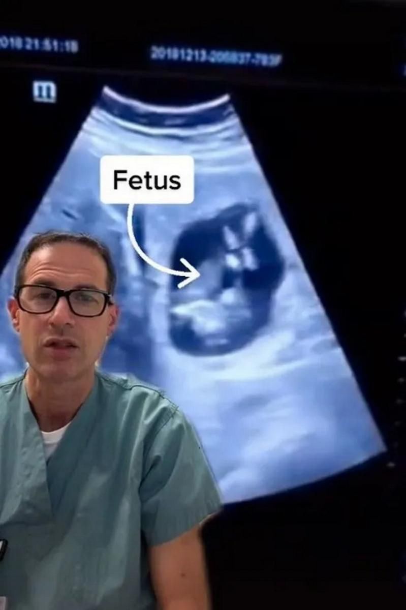 Dziecko odkryte w wątrobie kobiety