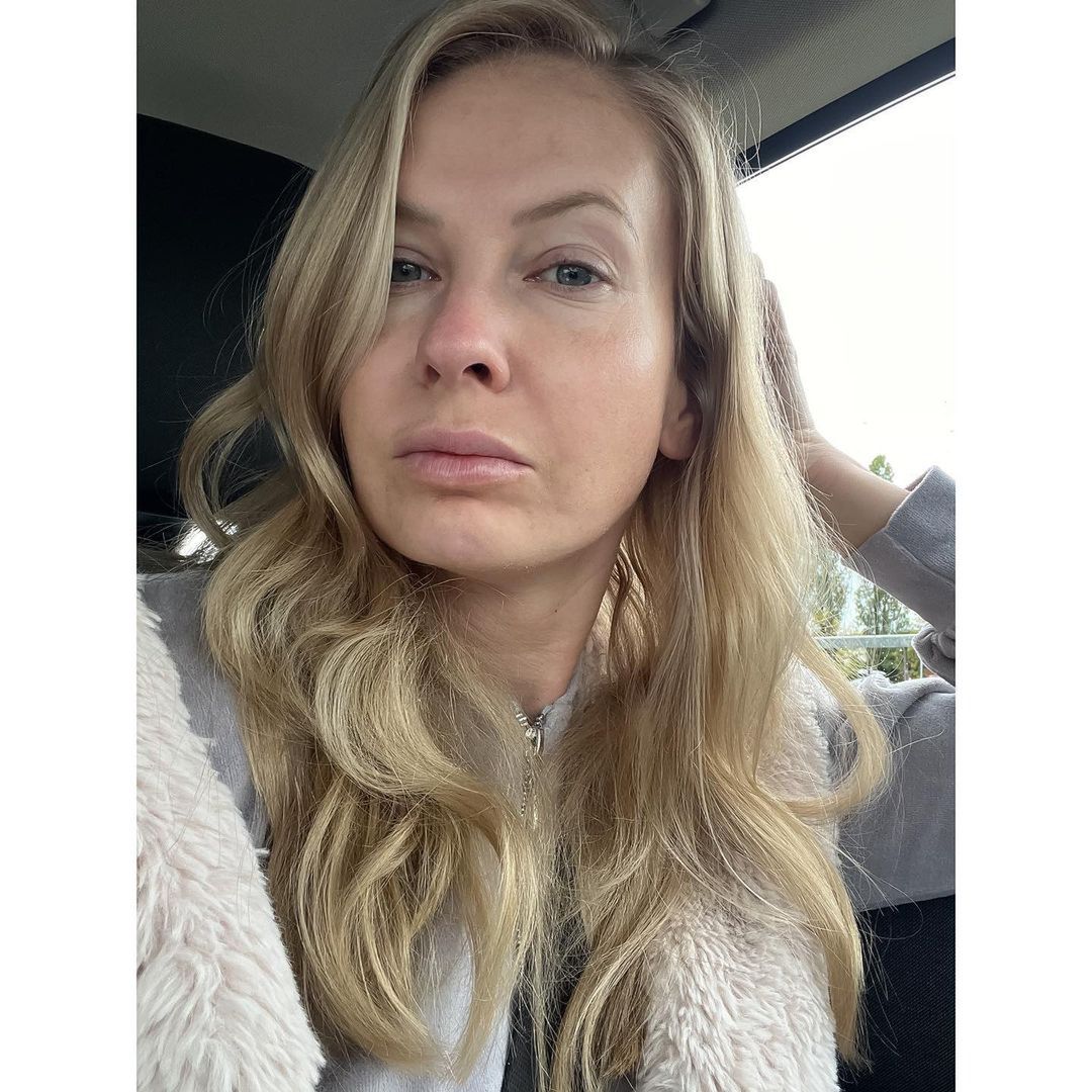 Edyta Pazura zdradza, co sądzi o medycynie estetycznej