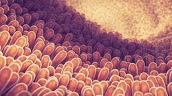 5 cichych znaków, świadczących o tym, że masz zespół nieszczelnego jelita