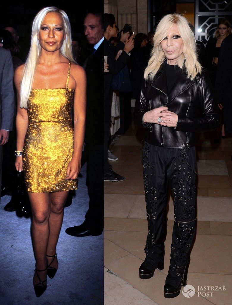 Donatella Versace w 1996 roku (po lewej) i w 2016 roku (po prawej) (fot. ONS)