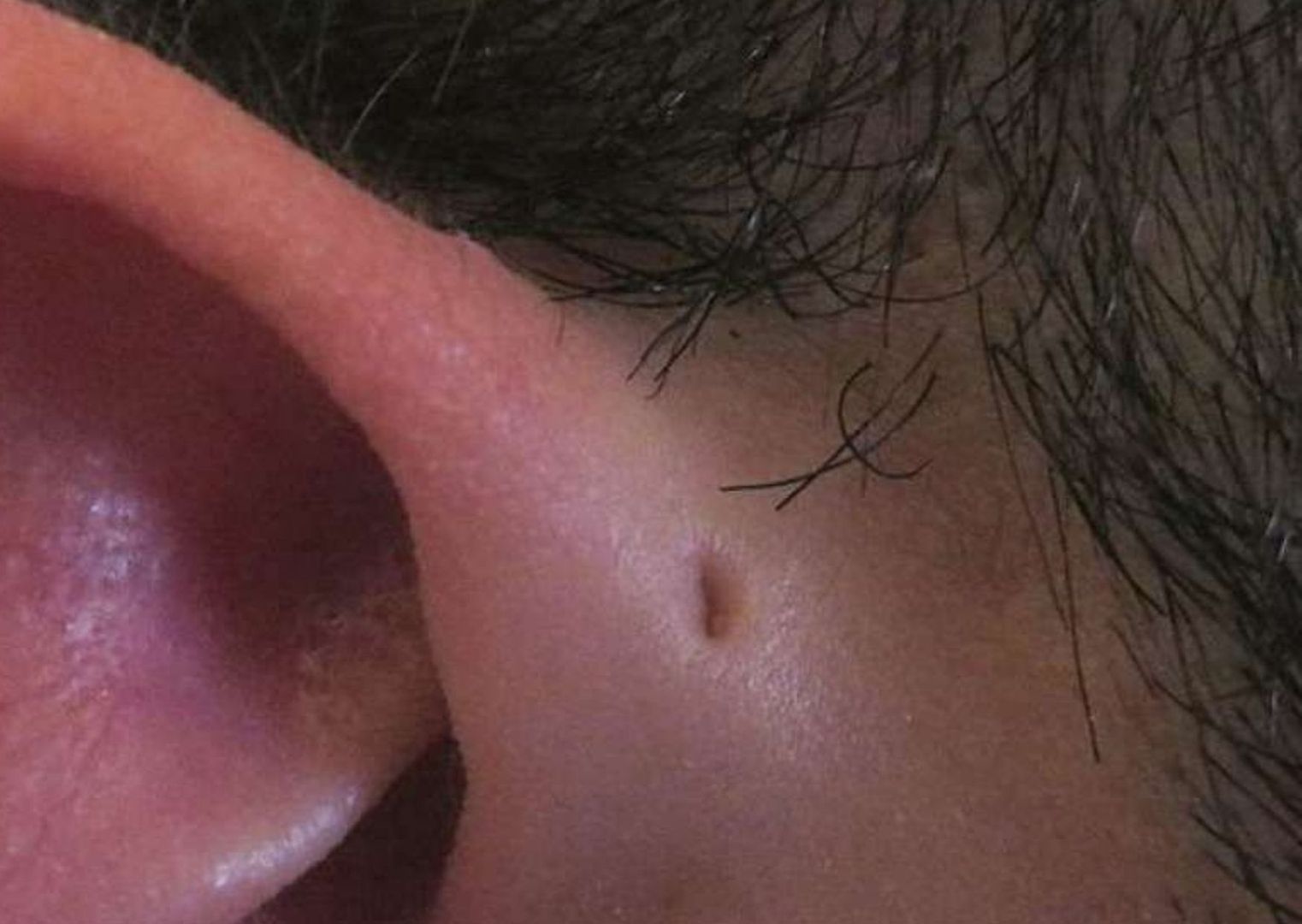 Czy wiesz, co oznacza dziurka przy uchu?