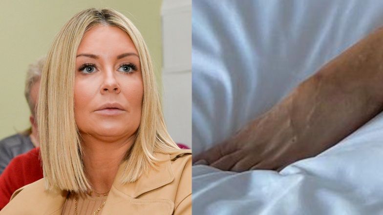 Fani zaniepokojeni kształtem lewej stopy Małgorzaty Rozenek