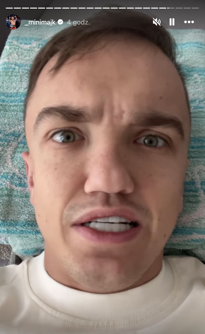 Mini Majk zaprezentował odmieniony uśmiech
