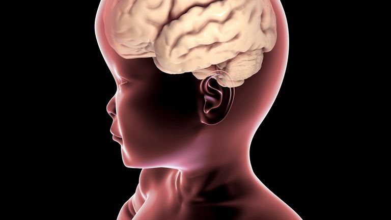 Zespół Costello to bardzo rzadko występująca choroba dziedziczna