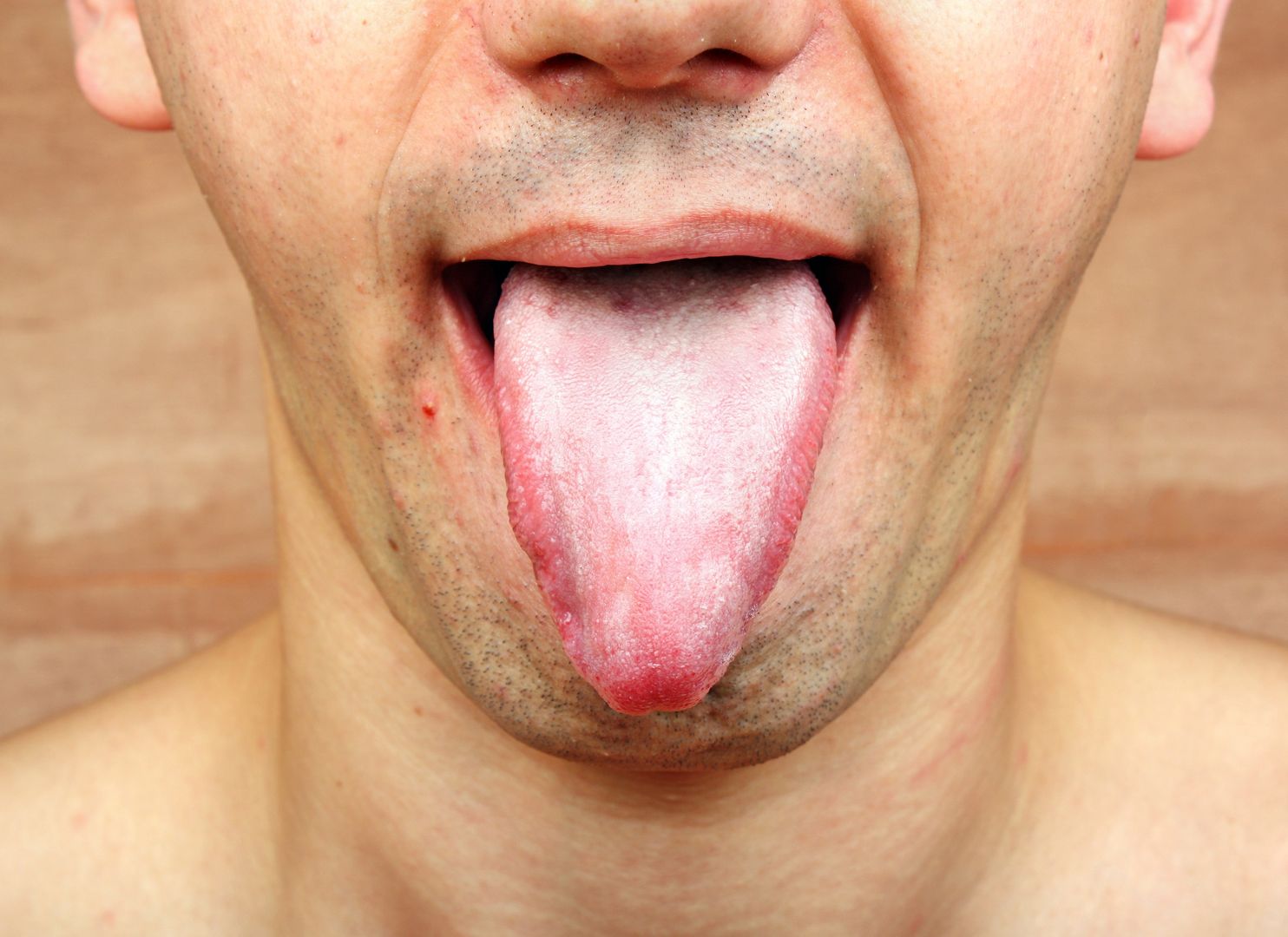 Obejrzyj swój język i sprawdź, czy jesteś zdrowy.
