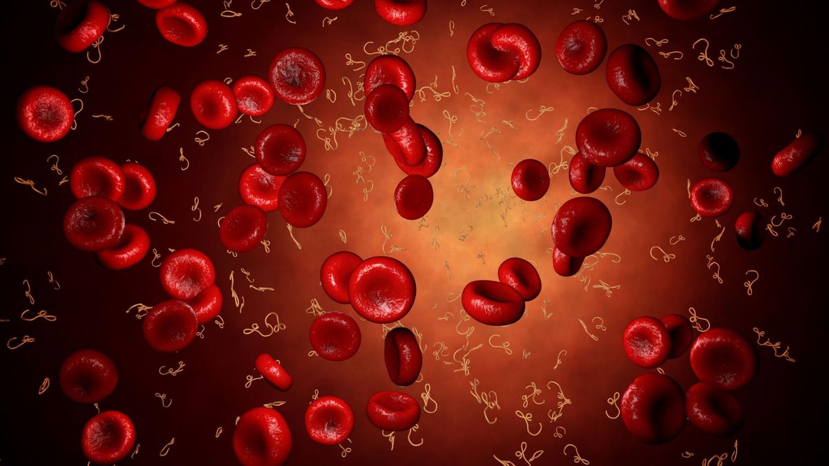 Naczyniak jamisty – charakterystyka, przyczyny, objawy, leczenie