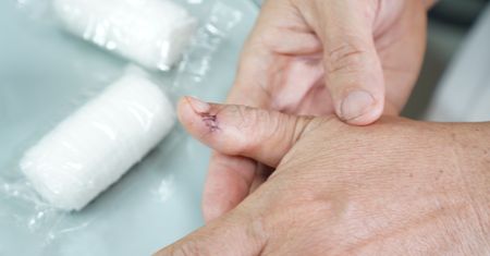 Prawdopodobnie pierwszy taki przypadek. Groźna infekcja odnotowana na Alasce