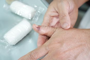 Prawdopodobnie pierwszy taki przypadek. Groźna infekcja odnotowana na Alasce