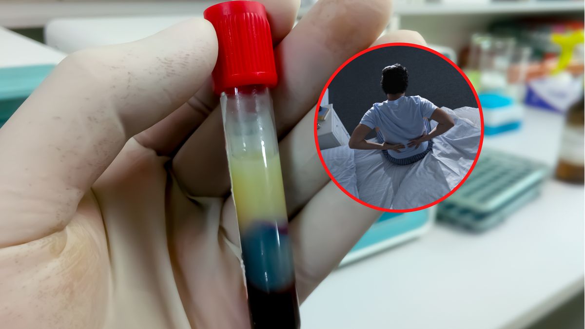 Miażdżyca długo nie daje objawów