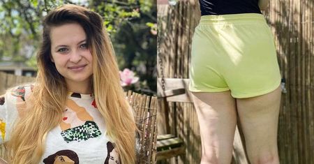 Szorty tylko dla szczupłych? "Boję się, że mnie wyśmieją"