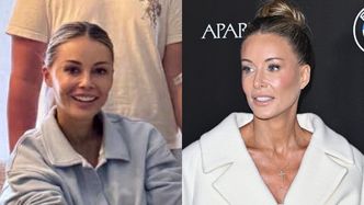 Podejrzanie gładka Małgorzata Rozenek-Majdan uśmiecha się na Instagramie. Zaszalała z retuszem? (FOTO)