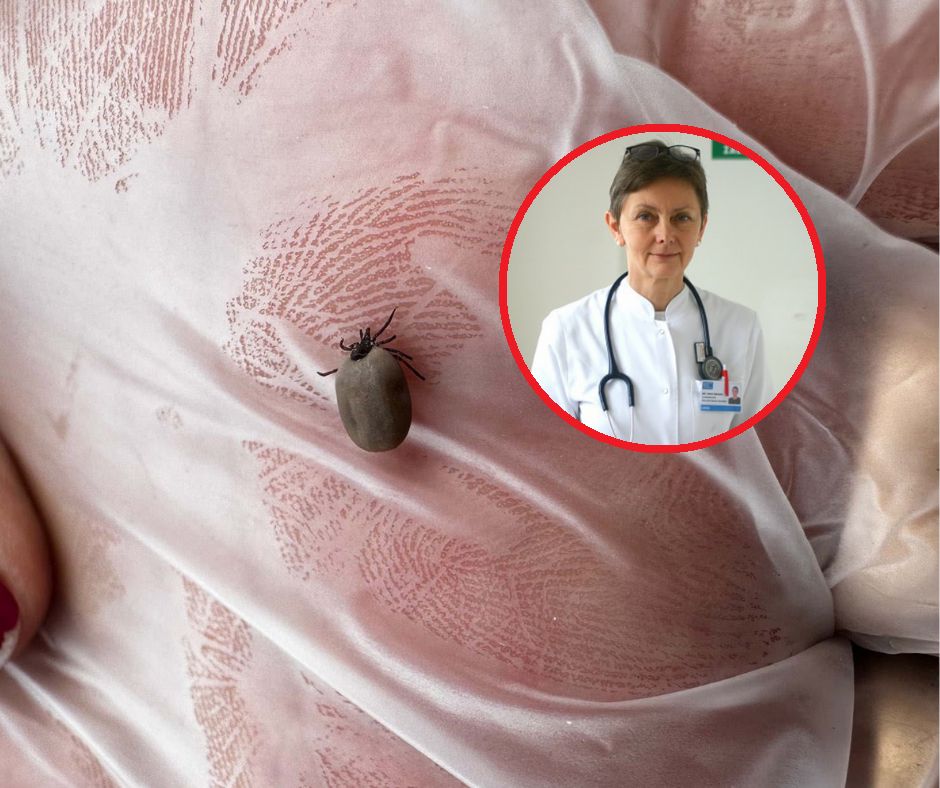 Trwają prace nad szczepionką na boreliozę. Prof. Zajkowska: Monitorujemy uczestników