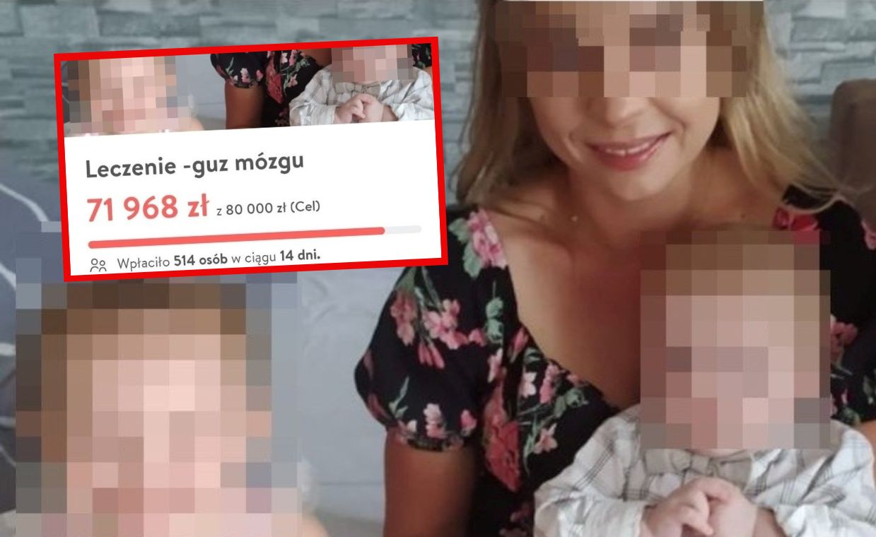 Oszustka z Dolnego Śląska wymyśliła guza mózgu. Prokuratura ma ważny apel