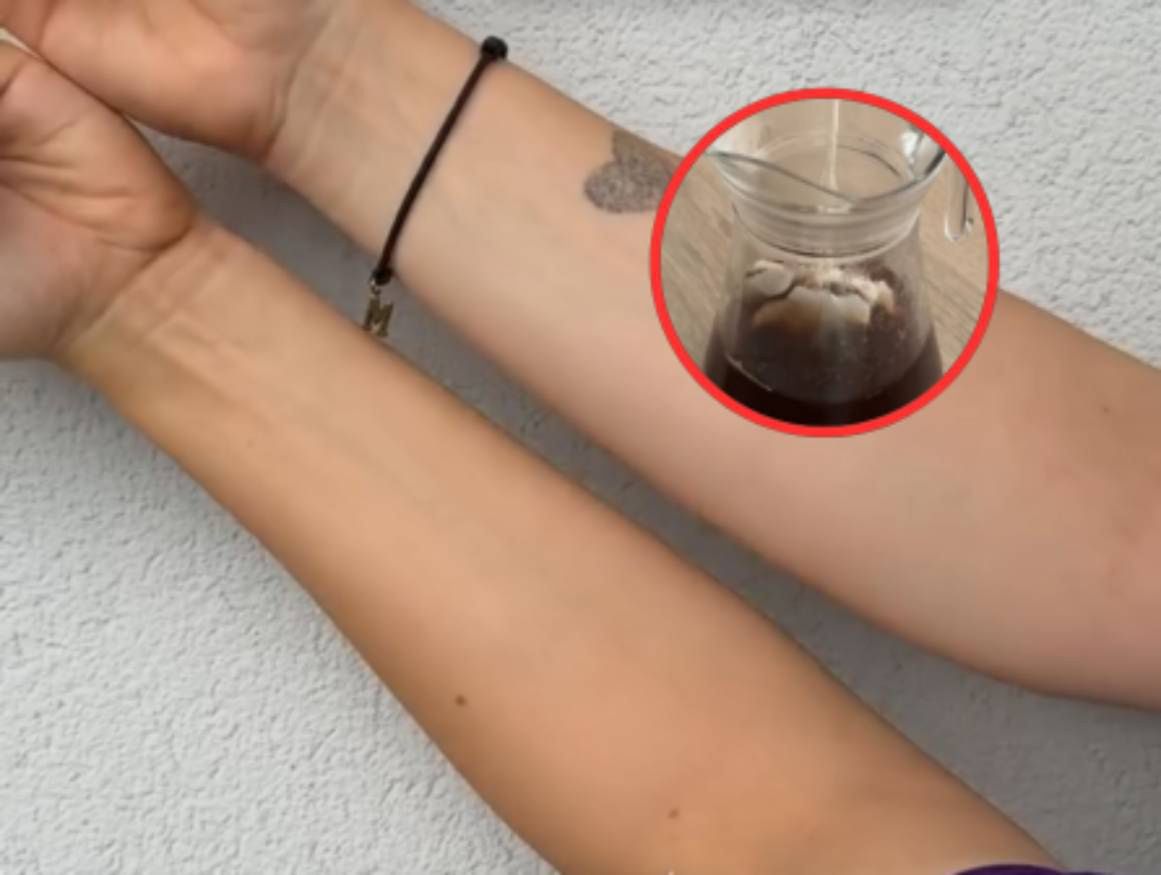 Jak przyciemnić skórę naturalną metodą? 