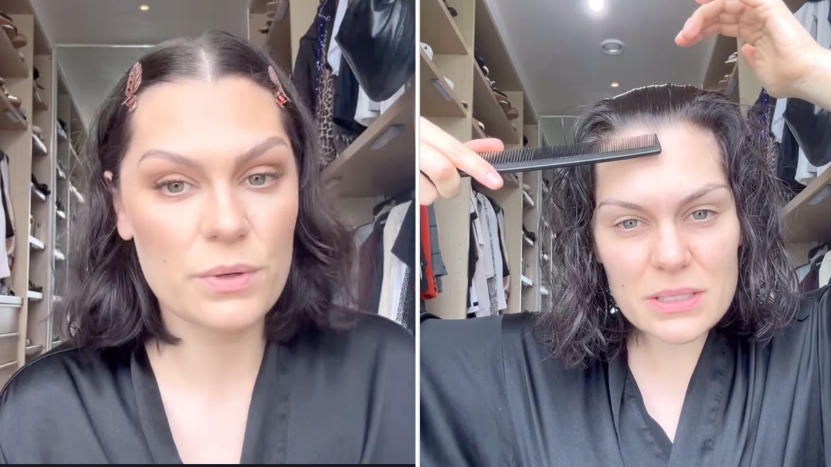 Jessie J boryka się z wypadaniem włosów po mastektomii