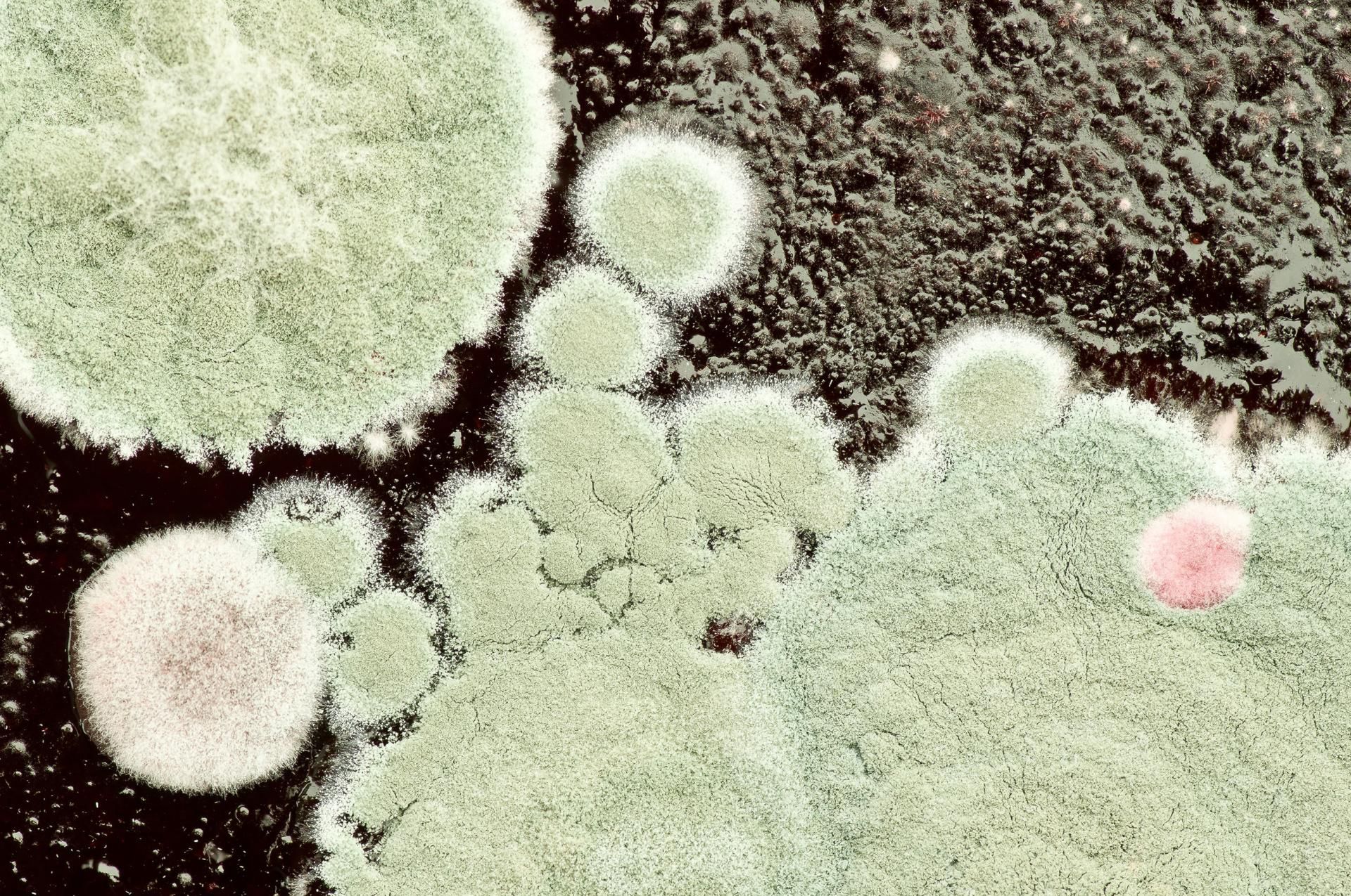 Pleśnie są zbudowane ze strzępek