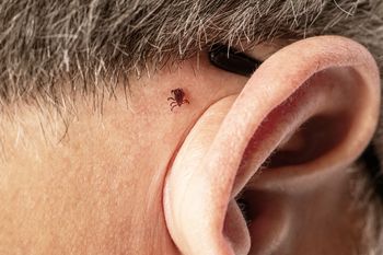 Kleszcze nie lubią tej grupy krwi. Badania mówią jasno