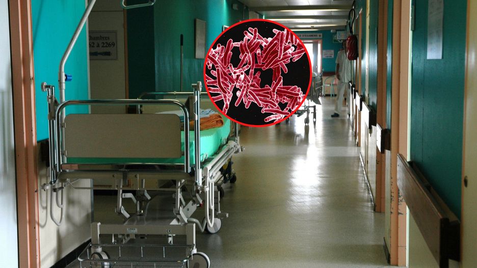 W Czechach zanotowano wzrost przypadków gruźlicy