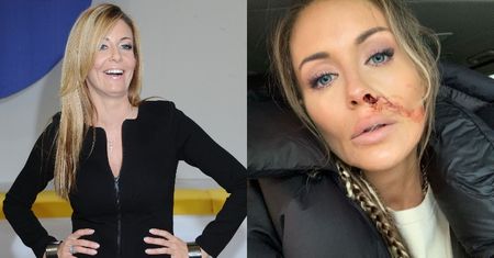 "Zakrwawiona" Małgorzata Rozenek podsumowuje kąśliwą "fankę": "W kategorii "najgłupszy komentarz" JESTEŚ NA PODIUM"