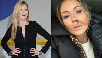 "Zakrwawiona" Małgorzata Rozenek podsumowuje kąśliwą "fankę": "W kategorii "najgłupszy komentarz" JESTEŚ NA PODIUM"
