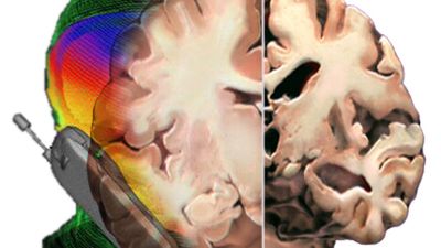 Ochronne działanie promieniowania komórek? 1