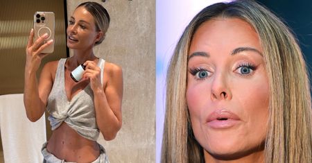 Wysportowana Małgorzata Rozenek eksponuje zabójczą sylwetkę. Forma życia? (FOTO)