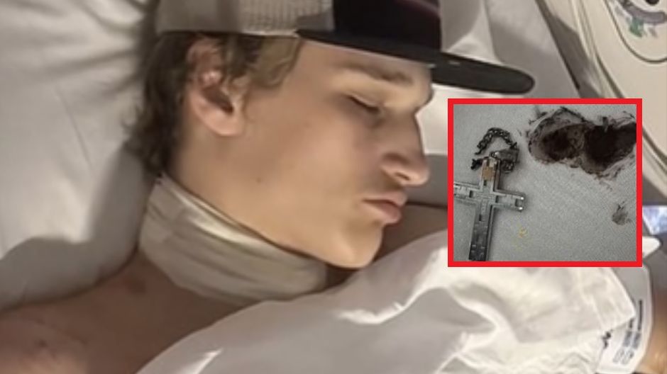 Nastolatek sięgał po telefon. Nagle łańcuszek wtopił mu się w szyję