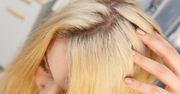 Włosy wyglądają jak strąki? Winna może być odżywka