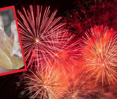 Petarda w dłoni dziecka. Youtuber pokazał efekt eksplozji