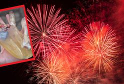 Petarda w dłoni dziecka. Youtuber pokazał efekt eksplozji