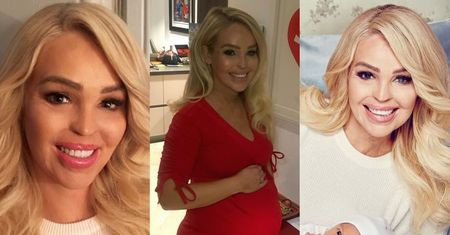 Tak dziś wygląda modelka oblana kwasem! Katie Piper urodziła właśnie drugie dziecko (ZDJĘCIA)