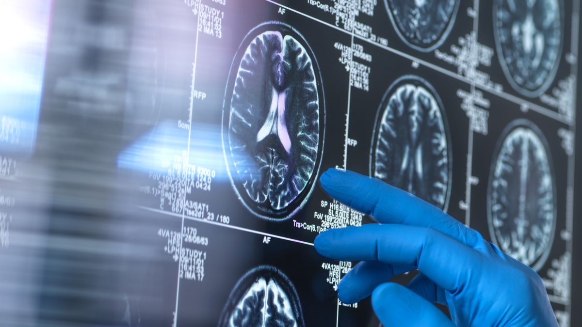 Naukowcy obalili mit związany z demencją