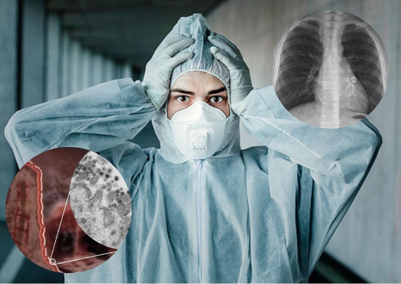 Groźne powikłania po chorobie COVID-19. Jakie narządy może uszkodzić koronawirus?