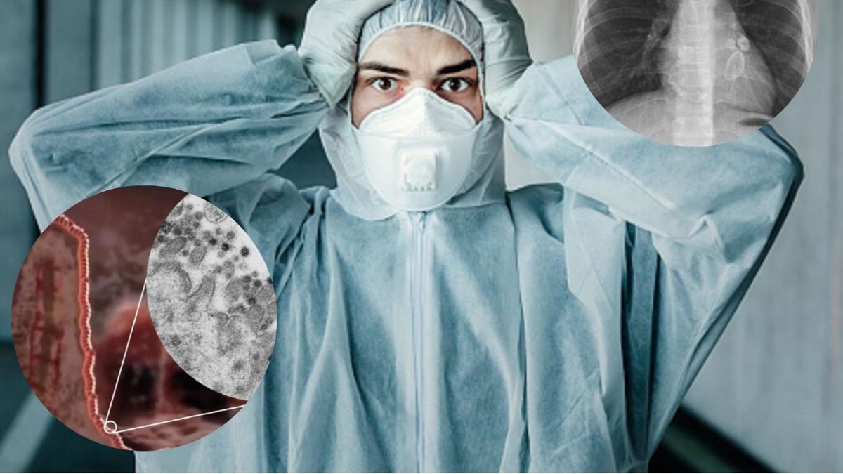 COVID-19 może prowadzić do niebezpiecznych powikłań